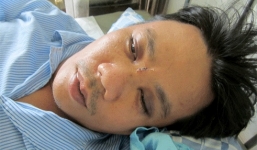 Bị côn đồ đánh, một kỹ sư nứt hộp sọ